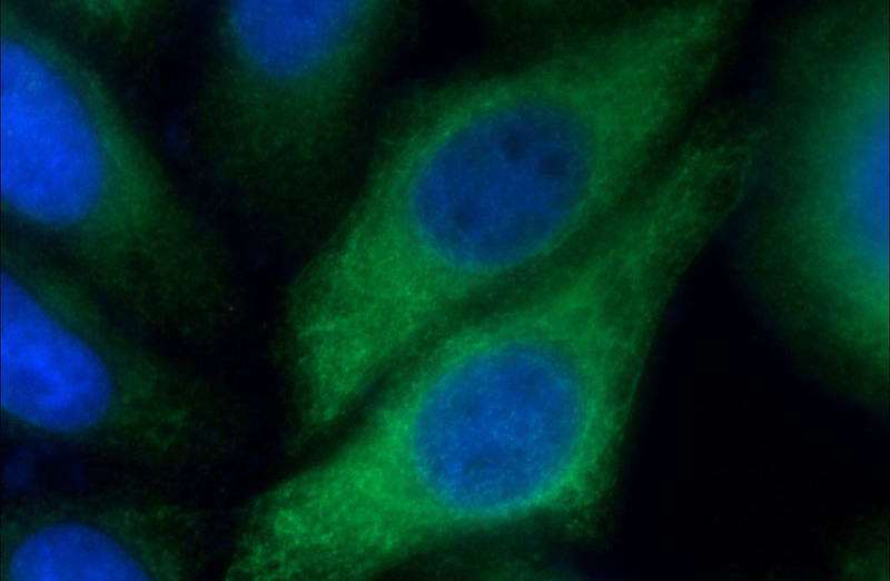 Immunofluorescent analysis of HepG2 cells using Catalog No:109792(KRT14 Antibody) at dilution of 1:50 and Alexa Fluor 488-congugated AffiniPure Goat Anti-Rabbit IgG(H+L)