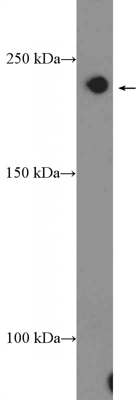 HEK-293 cells were subjected to SDS PAGE followed by western blot with Catalog No:108758(CACNA1D Antibody) at dilution of 1:300