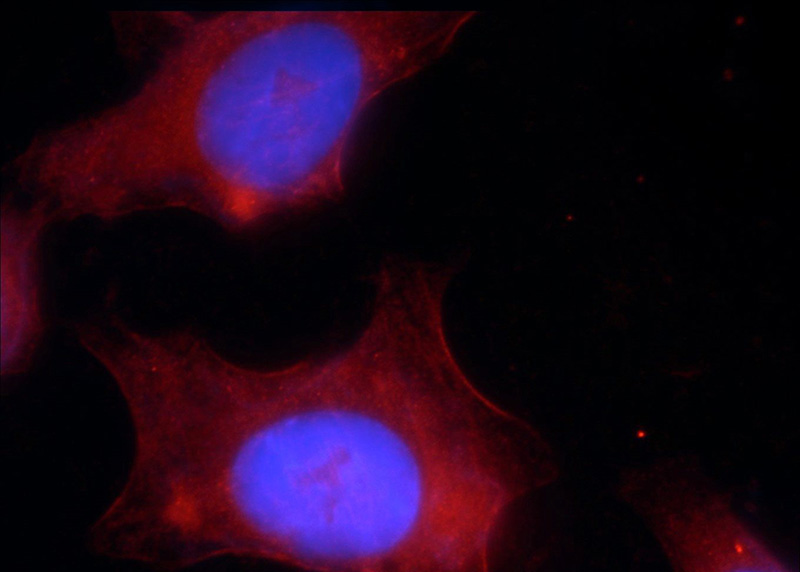 Immunofluorescent analysis of HepG2 cells using Catalog No:113371(NUMB Antibody) at dilution of 1:25 and Rhodamine-Goat anti-Rabbit IgG