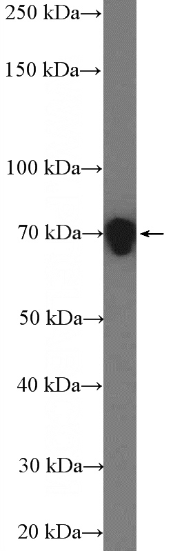 mouse brain tissue were subjected to SDS PAGE followed by western blot with Catalog No:109962(DNM1L,DLP1 Antibody) at dilution of 1:2000