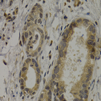 Immunohistochemistry - MAGEA1 Polyclonal Antibody 