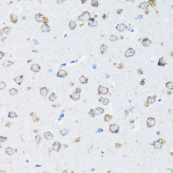 Immunohistochemistry - ARSB Polyclonal Antibody 