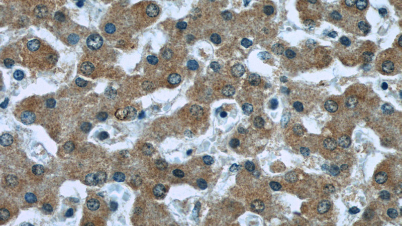 Immunohistochemistry of paraffin-embedded human liver slide using Catalog No:107033(CASP8 Antibody) at dilution of 1:50