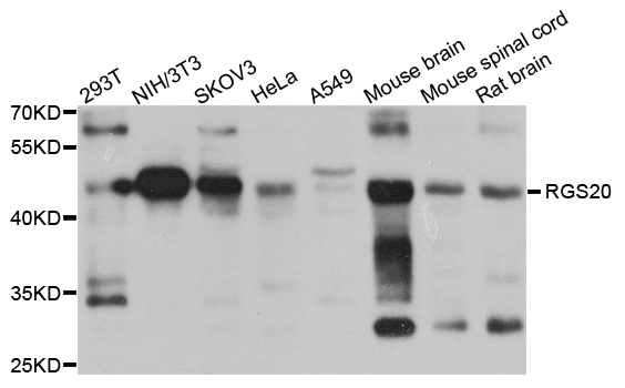 Western blot - RGS20 Polyclonal Antibody 