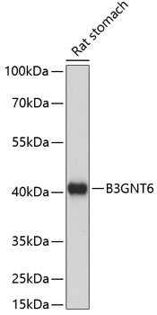 Western blot - B3GNT6 Polyclonal Antibody 
