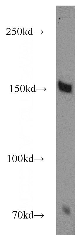 mouse lung tissue were subjected to SDS PAGE followed by western blot with Catalog No:116415(TRPS1 antibody) at dilution of 1:1000