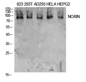 Fig1:; Western Blot analysis of 823, 293T, AD293, Hela, HepG2 cells using NOXIN Polyclonal Antibody. Antibody was diluted at 1:2000. Secondary antibody（catalog#：HA1001) was diluted at 1:20000