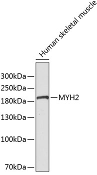 Western blot - MYH2 Polyclonal Antibody 