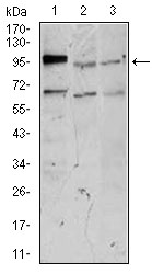 Western blot analysis using NEFM mouse mAb against NTERA-2 (1), SK-N-SH (2), and PC-12 (3) cell lysate.