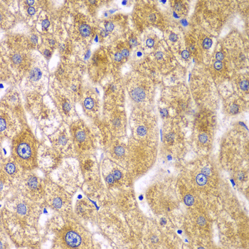 Immunohistochemistry - RPN1 Polyclonal Antibody 