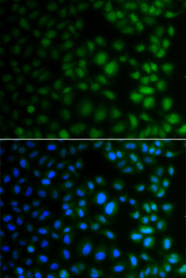 Immunofluorescence - NAA40 Polyclonal Antibody 
