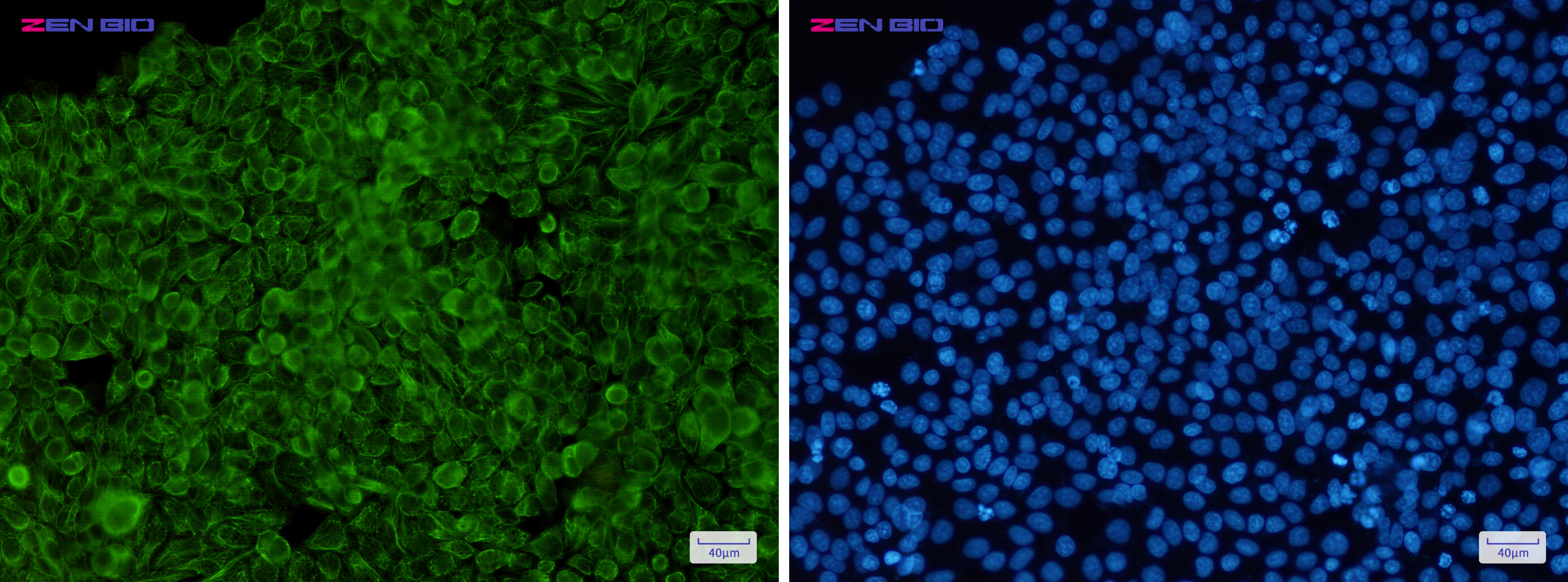 Immunocytochemistry of Cytokeratin 8 (Phospho-Ser23)(green) in Hela cells using Cytokeratin 8 (Phospho-Ser23) Rabbit pAb at dilution 1/50, and DAPI(blue)
