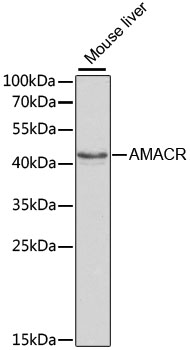 Western blot - AMACR Polyclonal Antibody 