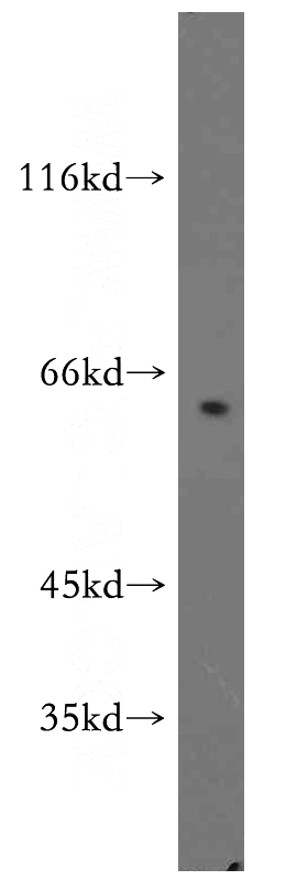 human testis tissue were subjected to SDS PAGE followed by western blot with Catalog No:109660(CCNA1 antibody) at dilution of 1:500