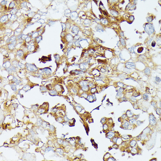 Immunohistochemistry - COX15 Polyclonal Antibody 