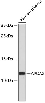 Western blot - APOA2 Polyclonal Antibody 