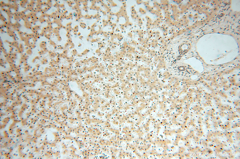 Immunohistochemical of paraffin-embedded human liver using Catalog No:112810(MRPL11 antibody) at dilution of 1:50 (under 10x lens)