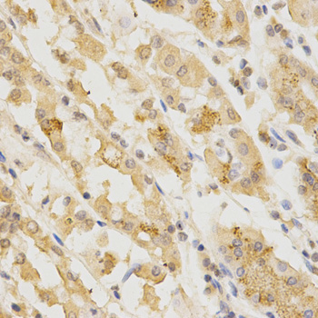 Immunohistochemistry - GGA2 Polyclonal Antibody 