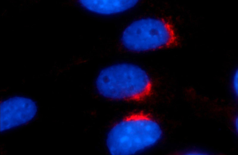 Immunofluorescent analysis of NIH/3T3 cells using Catalog No:116807(VTI1A Antibody) at dilution of 1:25 and Rhodamine-Goat anti-Rabbit IgG