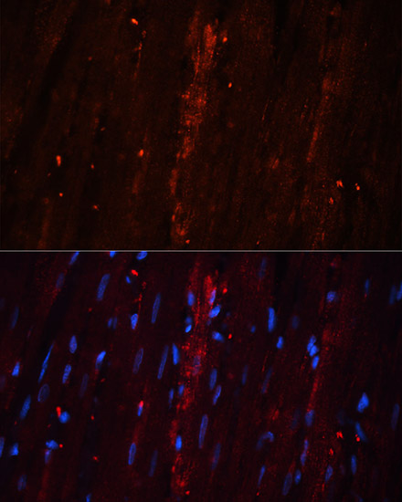 Immunofluorescence - CORO1A Polyclonal Antibody 