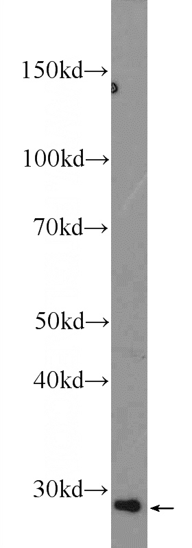 mouse kidney tissue were subjected to SDS PAGE followed by western blot with Catalog No:114159(PPT2 Antibody) at dilution of 1:600