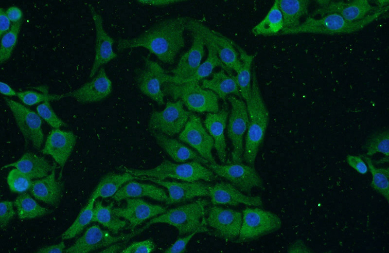 Immunofluorescent analysis of SH-SY5Y cells using Catalog No:113234(GRIN2B Antibody) at dilution of 1:25 and Alexa Fluor 488-congugated AffiniPure Goat Anti-Rabbit IgG(H+L)