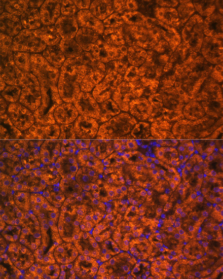 Immunofluorescence - SCNN1A Polyclonal Antibody 