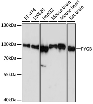Western blot - PYGB Polyclonal Antibody 
