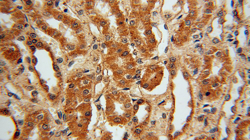 Immunohistochemical of paraffin-embedded human kidney using Catalog No:116538(UBE2U antibody) at dilution of 1:50 (under 40x lens)