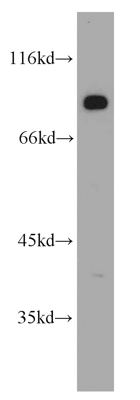 mouse brain tissue were subjected to SDS PAGE followed by western blot with Catalog No:109997(DLL4 antibody) at dilution of 1:300