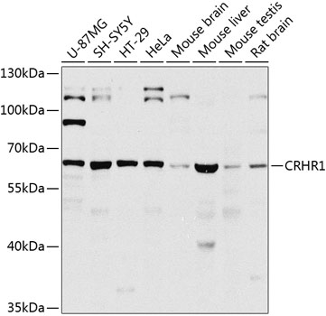 Western blot - CRHR1 Polyclonal Antibody 