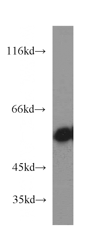 mouse thymus tissue were subjected to SDS PAGE followed by western blot with Catalog No:115254(SKAP55,SKAP1 antibody) at dilution of 1:300