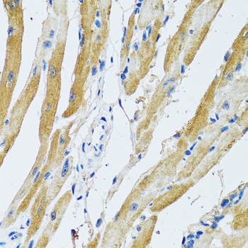 Immunohistochemistry - GDAP1 Polyclonal Antibody 
