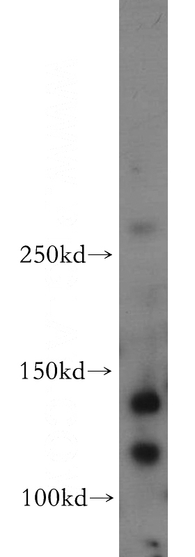 Neuro-2a cells were subjected to SDS PAGE followed by western blot with Catalog No:116348(Trappc9,NIBP antibody) at dilution of 1:300