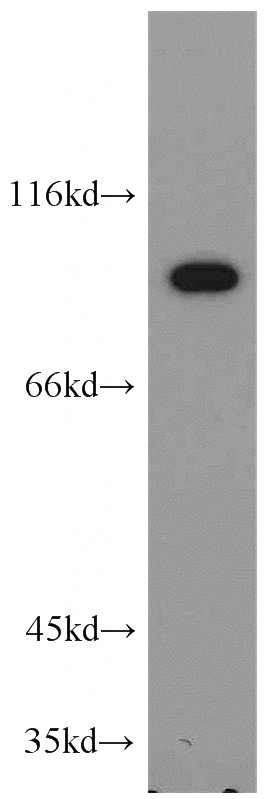 mouse kidney tissue were subjected to SDS PAGE followed by western blot with Catalog No:112235(LIN41 antibody) at dilution of 1:300