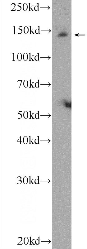 rat brain tissue were subjected to SDS PAGE followed by western blot with Catalog No:111885(JIP3 Antibody) at dilution of 1:600