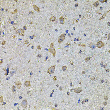 Immunohistochemistry - EIF4A2 Polyclonal Antibody 