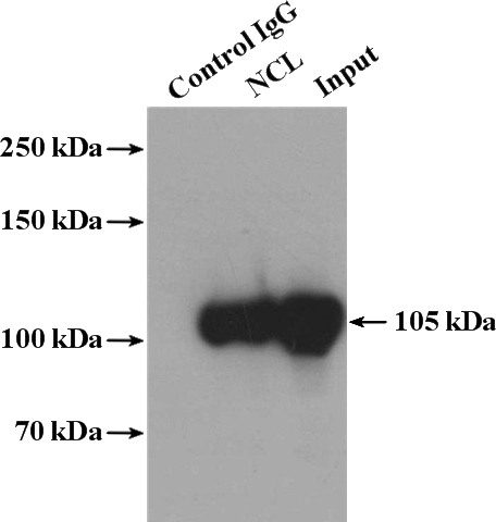 IP Result of anti-NCL (IP:Catalog No:113040, 4ug; Detection:Catalog No:113040 1:1000) with HeLa cells lysate 3200ug.