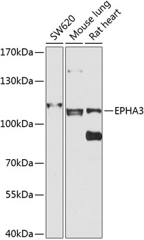 Western blot - EPHA3 Polyclonal Antibody 