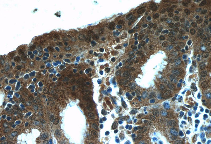 Immunohistochemistry of paraffin-embedded human stomach slide using Catalog No:113377(NUP205 Antibody) at dilution of 1:50