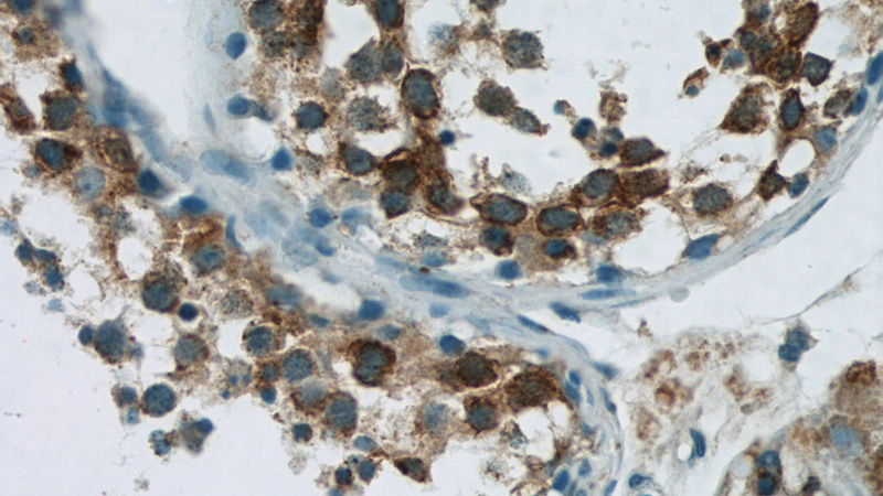 Immunohistochemistry of paraffin-embedded human testis tissue slide using Catalog No:112324(LRPAP1 Antibody) at dilution of 1:50 (under 40x lens)
