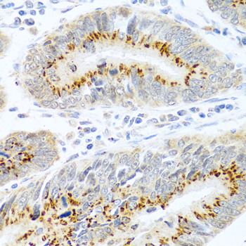 Immunohistochemistry - FAM3B Polyclonal Antibody 