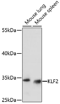 Western blot - KLF2 Polyclonal Antibody 