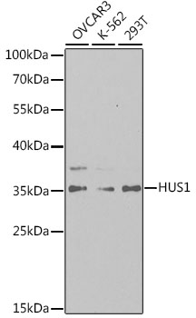 Western blot - HUS1 Polyclonal Antibody 