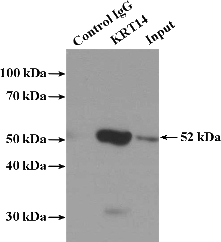 IP Result of anti-KRT14 (IP:Catalog No:109793, 4ug; Detection:Catalog No:109793 1:1000) with mouse skin tissue lysate 3200ug.