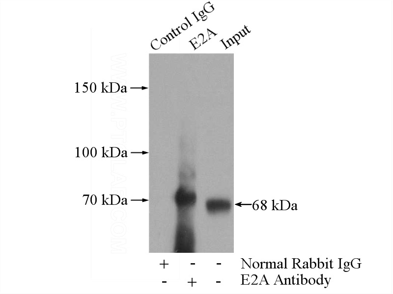 IP Result of anti-TCF3 (IP:Catalog No:110152, 4ug; Detection:Catalog No:110152 1:500) with Jurkat cells lysate 2800ug.