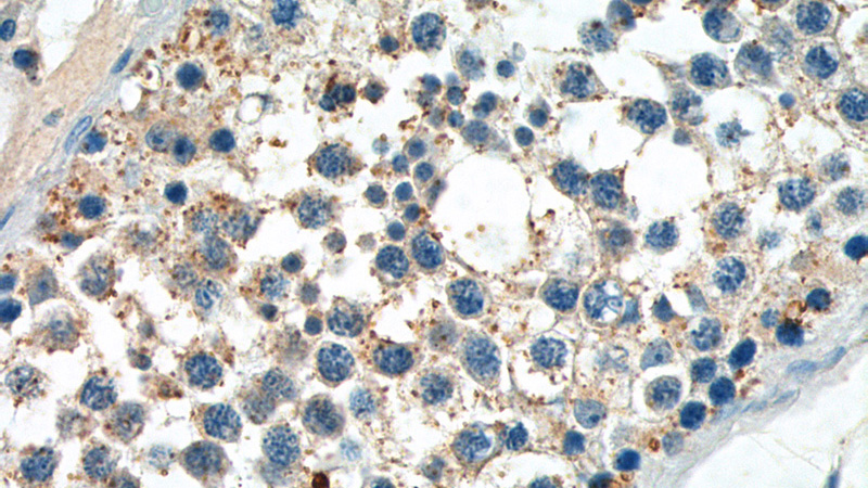 Immunohistochemistry of paraffin-embedded human testis tissue slide using Catalog No:113842(PIWIL2 Antibody) at dilution of 1:50 (under 40x lens)