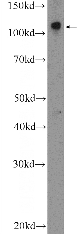 mouse lung tissue were subjected to SDS PAGE followed by western blot with Catalog No:114481(RASIP1 Antibody) at dilution of 1:300