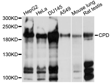 Western blot - CPD Polyclonal Antibody 