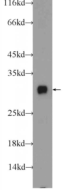 rat liver tissue were subjected to SDS PAGE followed by western blot with Catalog No:111849(INSIG2 Antibody) at dilution of 1:1000